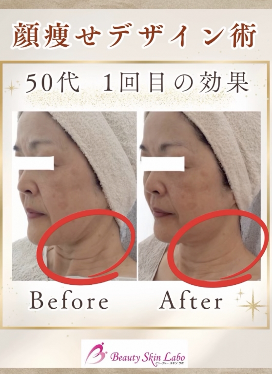 \ ラボの伝統と名医の革新 /〜✨顔痩せデザイン術✨〜　